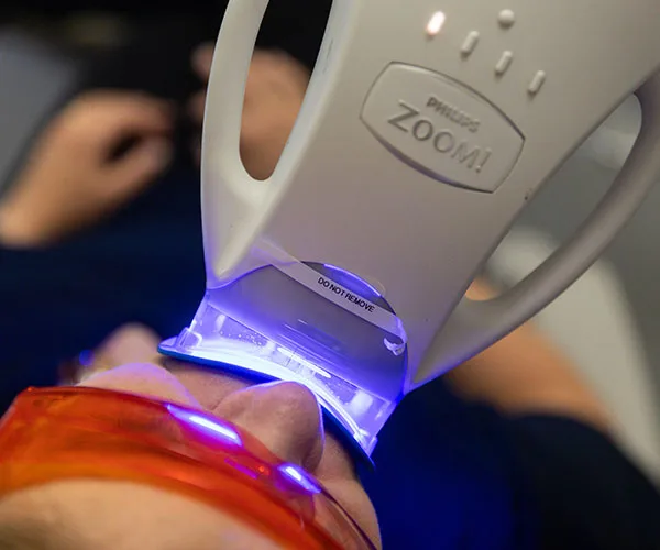 Dental whitening equipment pictured on the client’s About Us page